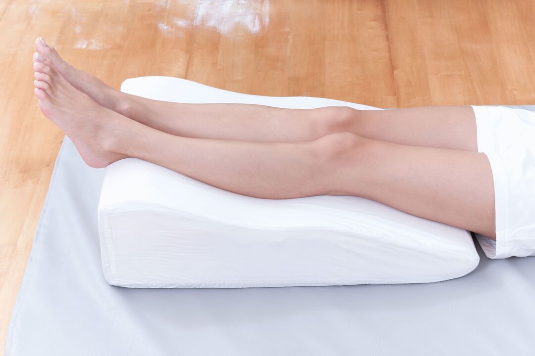 Preventing veins with varicose
