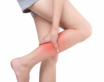 The symptoms of varicose veins