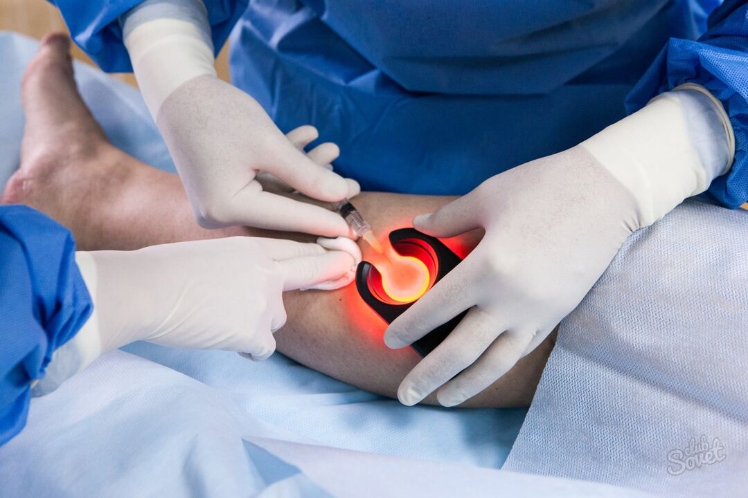 Varicose veins in the diagnosis of legs